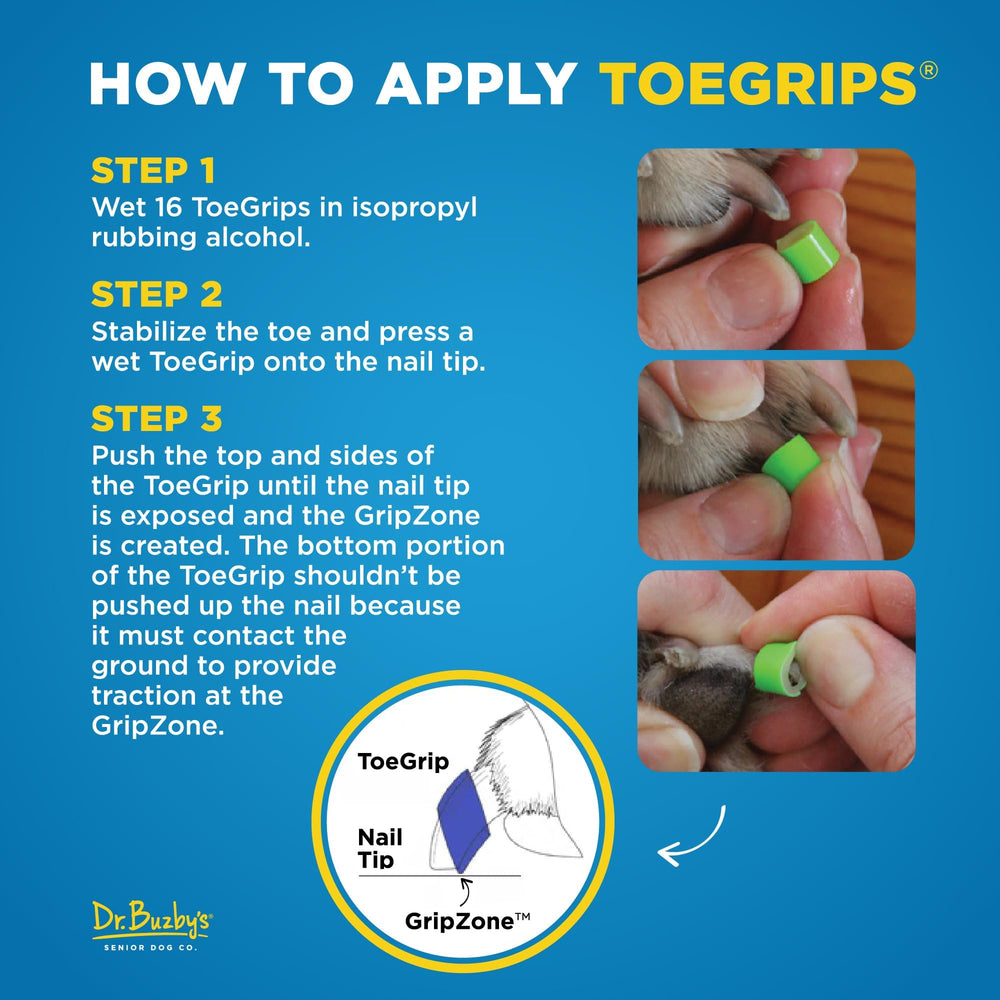 Confianza al caminar gracias a Dr. Buzby's ToeGrips