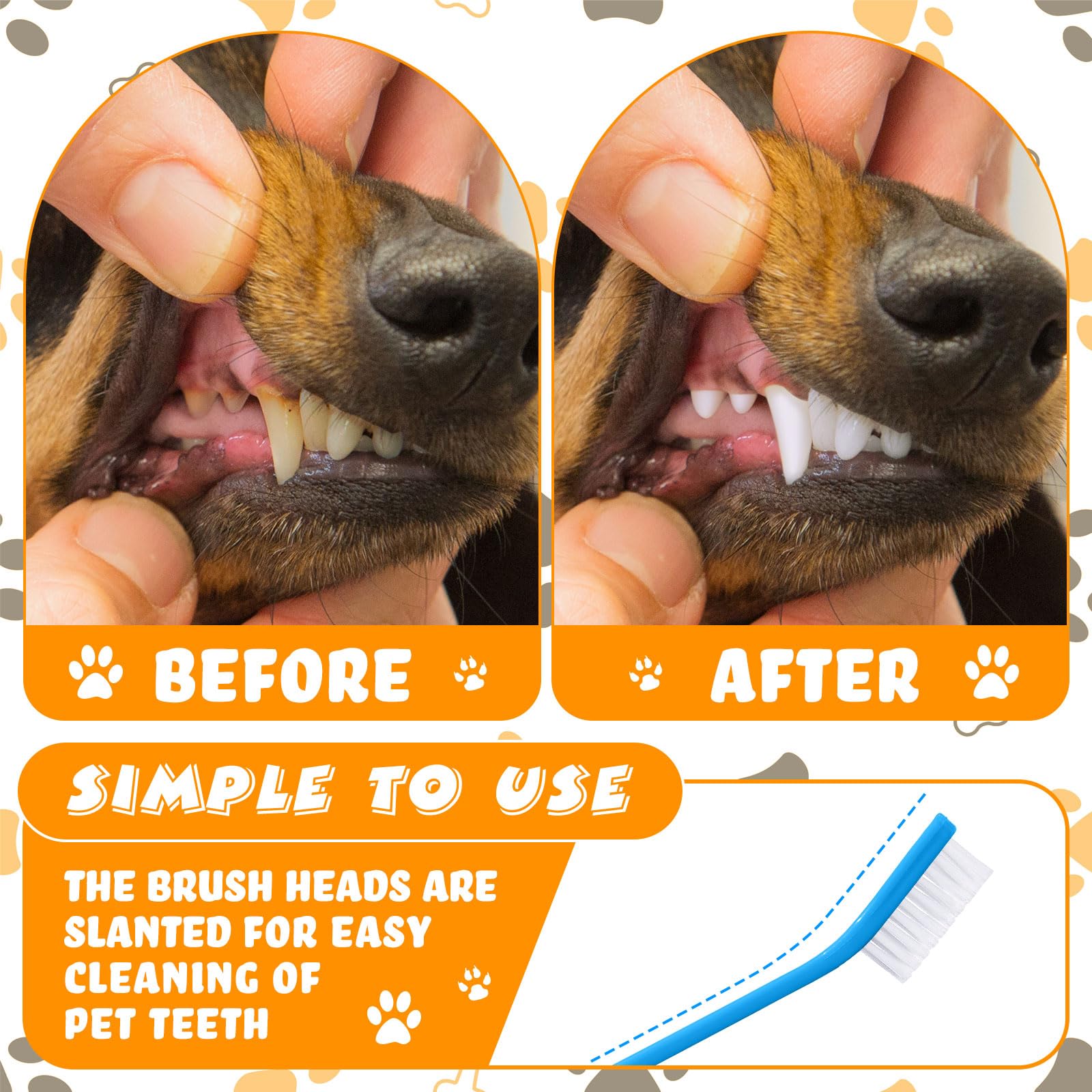 Nuenen cepillo dental con cerdas suaves de PP para dentición sensible.