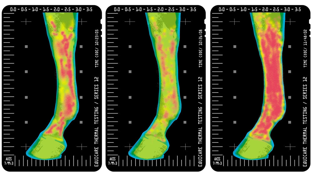 Aplicación manual de Vita Flex Thermaflex Gel durante masaje suave